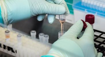 Hands of CDC scientist as they prepare to test a patient’s sample for SARS-CoV-2