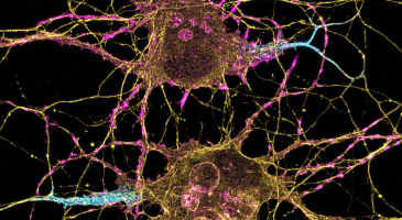 NIH photo of neurons