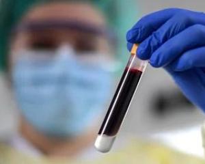 Masked researcher holding vial of blood - Britta Pedersen/dpa/picture alliance via Getty Images