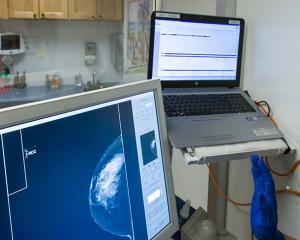 Medical staff review mammogram on computer screen. Photo by Robert Hood / Fred Hutch News Service