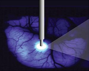 Optogenetics illustration