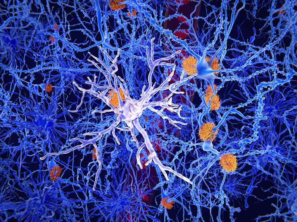 Stock photo showing microglia cell